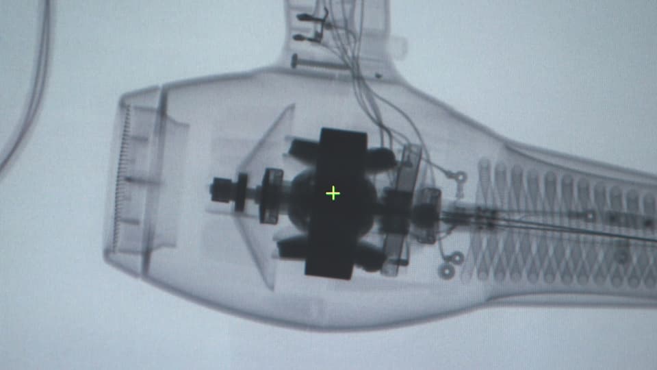 Auf dem Röntgenbild werden technische Details des Ionen-Föns sichtbar.