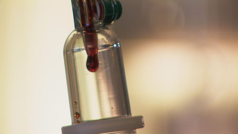 Infusionen mit Eisen Wie viel Eisen darf es sein? News SRF