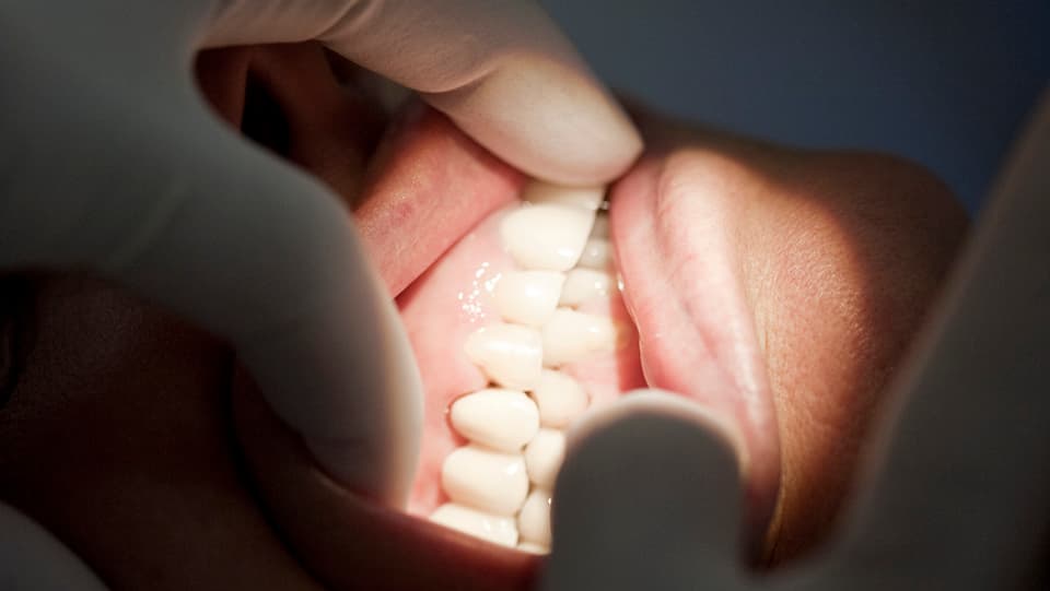 Ein Mund, der mit Handschuhen geöffnet wird bei einem Zahnarztbesuch