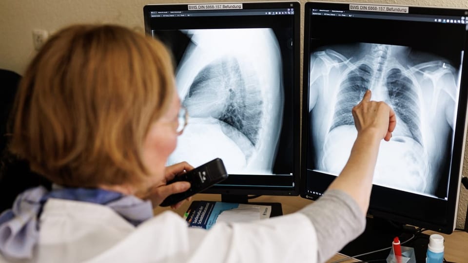 Eine Ärztin beschäftigt sich mit einem Lungen-Röntgenbild