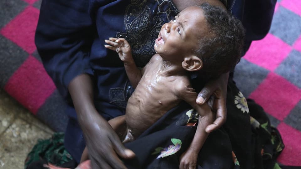 Ein unterernährtes Baby in den Armen seiner Mutter.