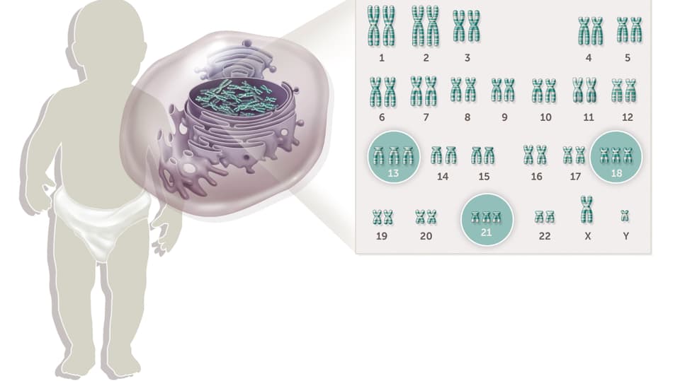 Illustration einer Schautafel, auf der die 22 menschlichen Chromosomenpaare aufgezeigt sind. Links davon ein Baby.