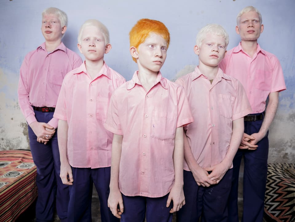 Fünf Albino-Knaben in rosa Hemden.