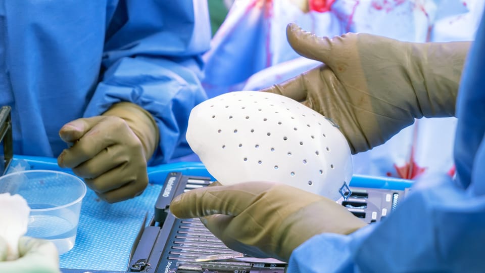 Medizinpersonal hält eine Kunststoffschale mit Lächern