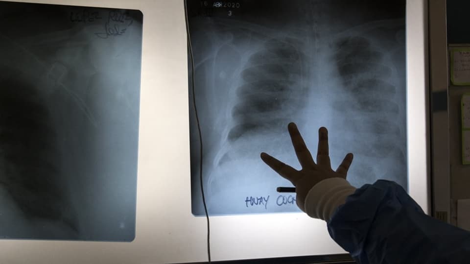 Arzt prüft Röntgenbild