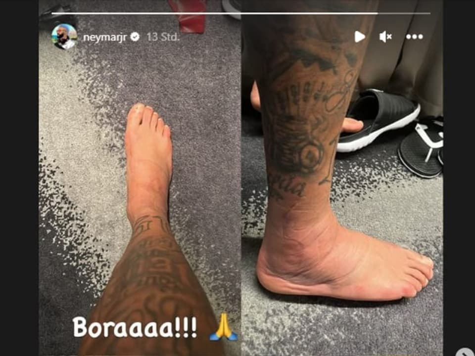 Neymar teilte Bilder seines geschwollenen Knöchels auf Instagram.