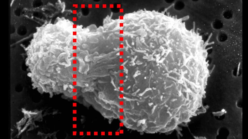Rasteraufnahme vom Kampf des Immunsystems gegen eine Krebszelle