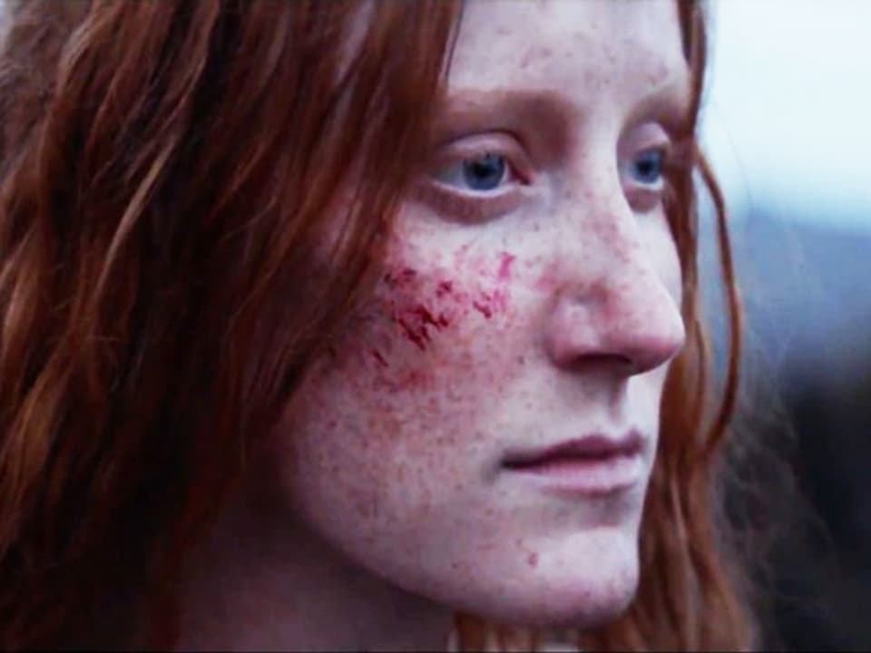 Ein Porträt einer Frau mit roten Haaren. Sie hat einen Kratzer im Gesicht.