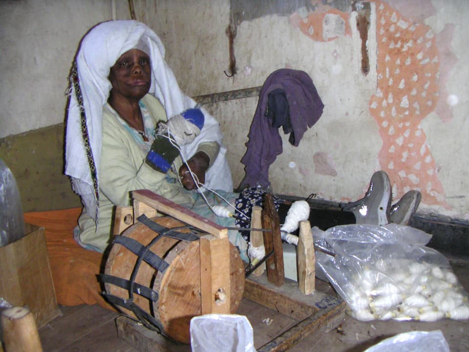 Eine Lepra-kranke Frau in Äthiopien.
