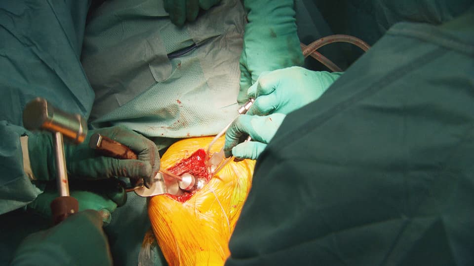 Aufnahme während einer Schulterprothesen-Operation. 