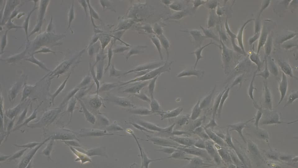 Knochenmarkstammzellen unter dem Mikroskop
