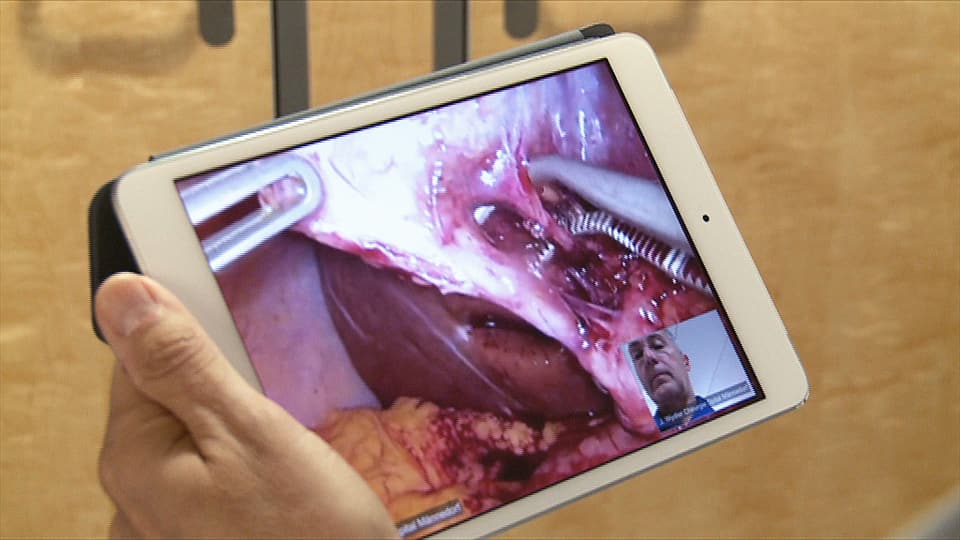 Ein Tablet-PC übermittelt Bilder während einer Operation an einen anderen Kollegen.