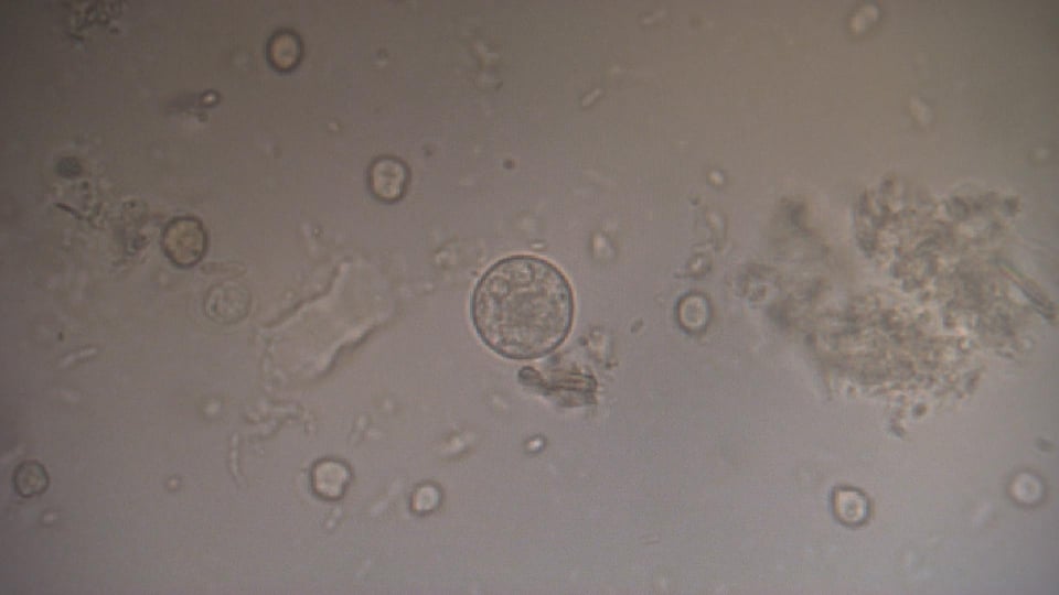 Amuba di bawah mikroskop