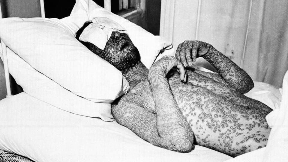 Mann mit Pocken, aufgenommen 1941.