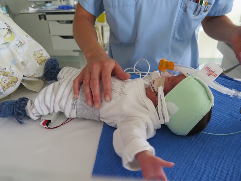 Frühgeborenes mit Atemhilfe