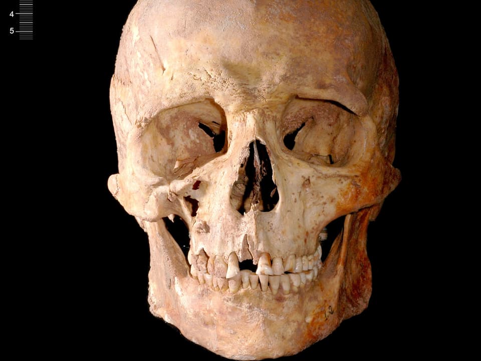 Der Schädel des Ur-Menschen in einer Frontalaufnahme, die auch die gut erhaltenen Zähne zeigt.