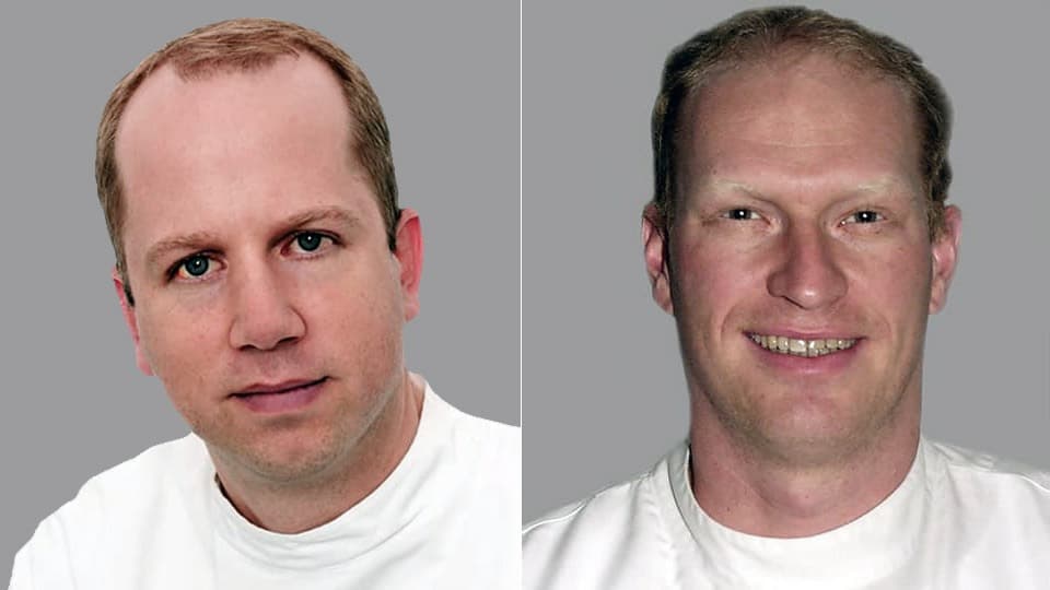 Dr. Beat Roth und Dr. Frédéric Birkhäuser