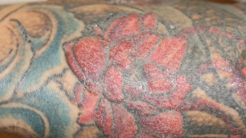 Schuppige Haut bei einem Tattoo.