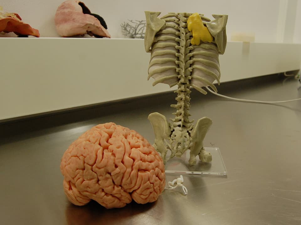 Hirn-Modell aus Kautschuk, daneben krankes Gefäss, dahinter ein Brustkorb mit Tumor
