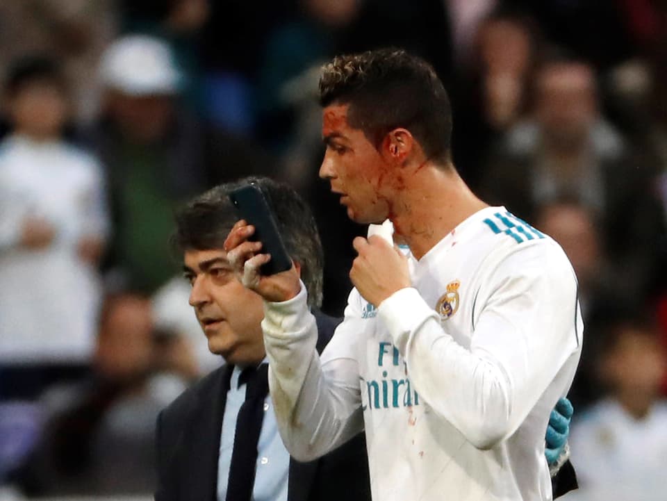 Cristiano Ronaldo schaut seine Wunden im Handy an