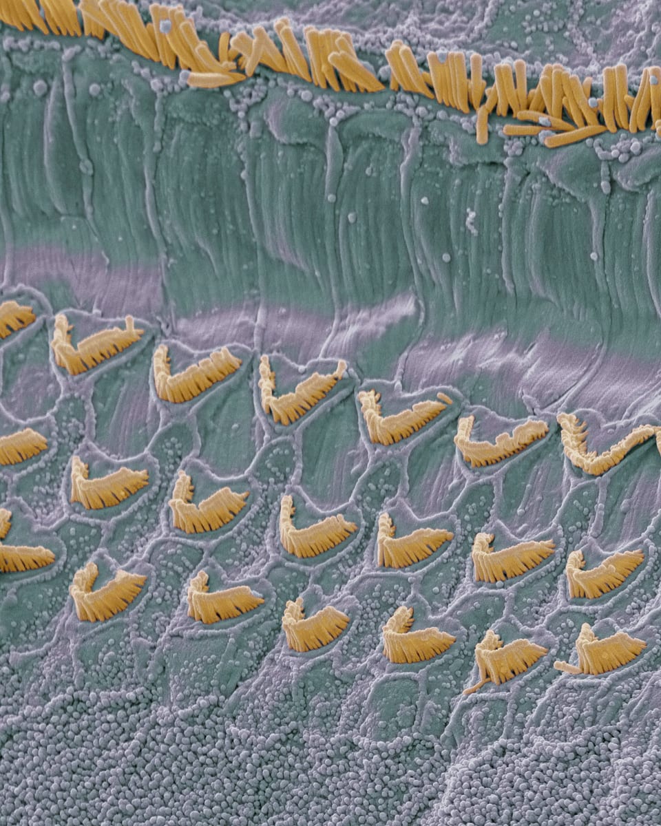Makroskopische Darstellung der Haarsinneszellen im Innenohr.
