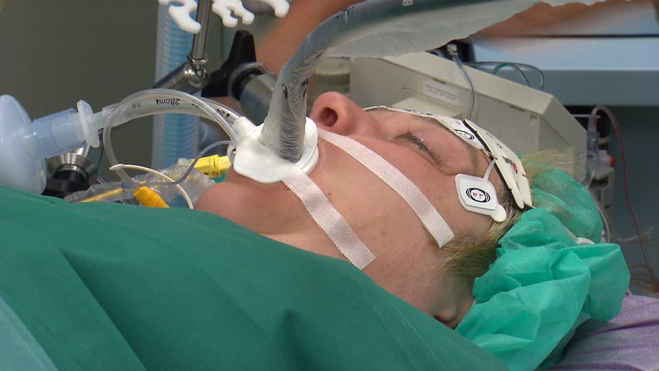 Kopf der Patientin mit dem Intubationsschlauch.