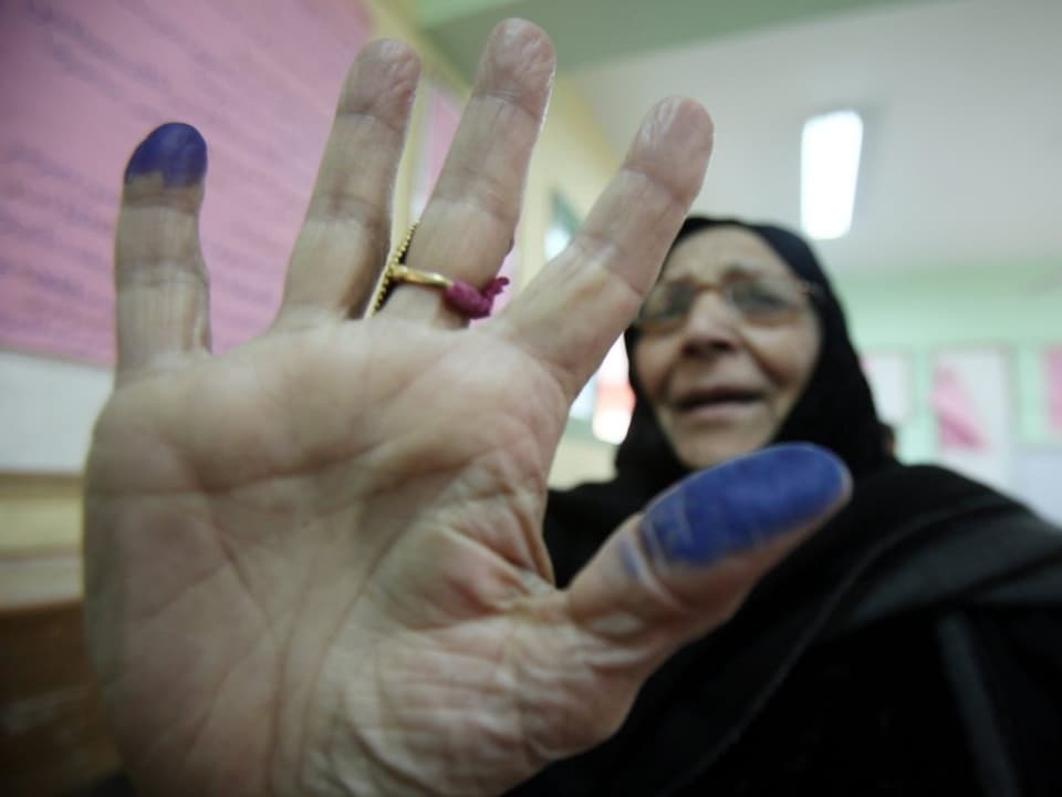Frau, die blaugefärbte Fingerkuppen zeigt.