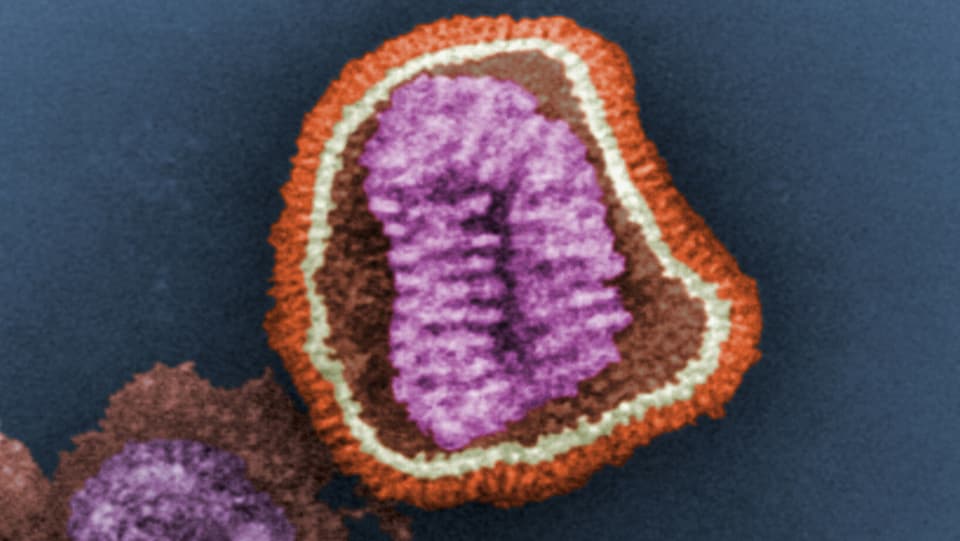 Ein Bild des H1N1-Virus.