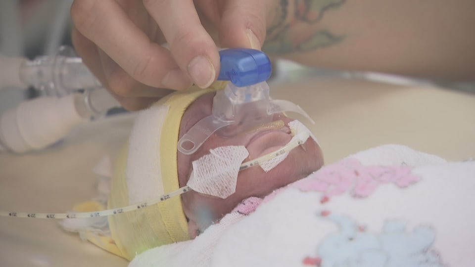 Ein Frühgeborenes auf der Neonatologie in Chur. Es kann nicht gut atmen, es geht ihm aber gut. 
