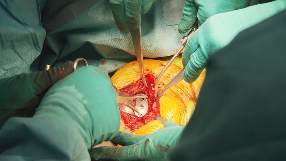 Aufnahmen aus dem Operationssaal während einer Schulterprothesen-Operation. 