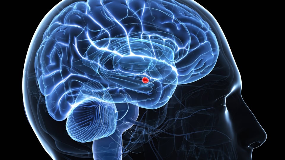 Schema des Gehirns mit der Amygdala als roten Punkt.
