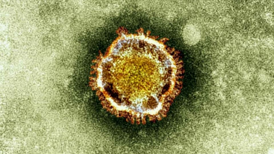 Mikroskop-Aufnahme eines Coronavirus.