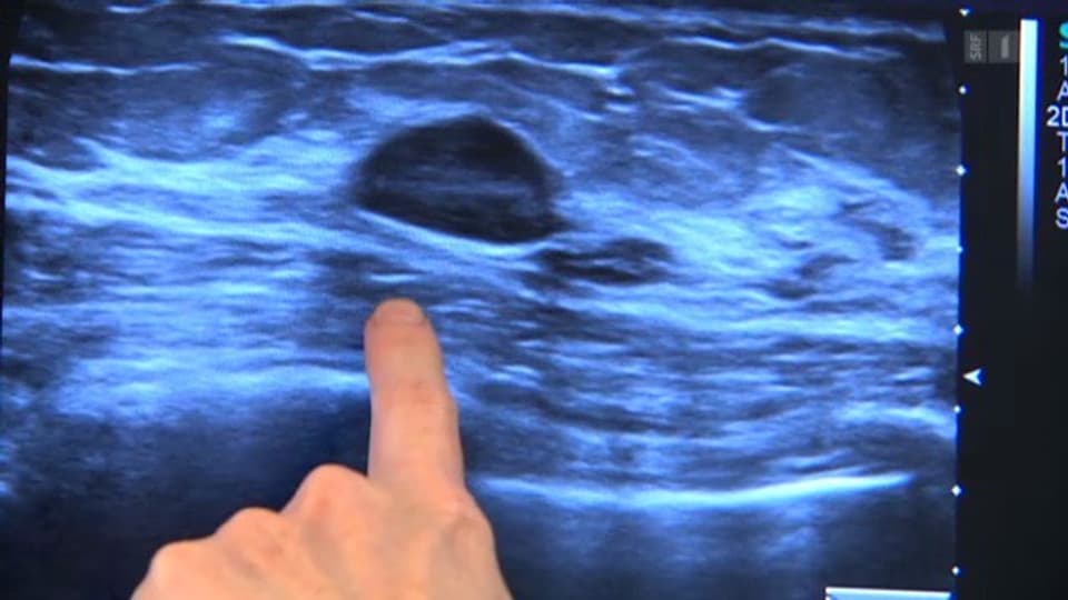 Körper & Geist Brust abtasten Nur mit Übung sinnvoll Puls SRF