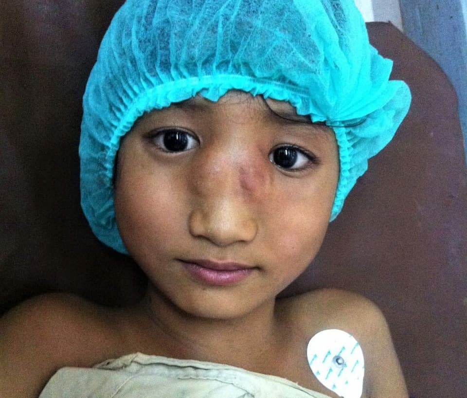 Verletzter Junge in Burma.