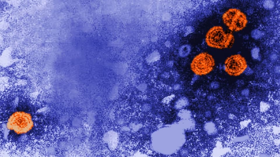 Virale Hepatitis: die unterschätzte Krankheit