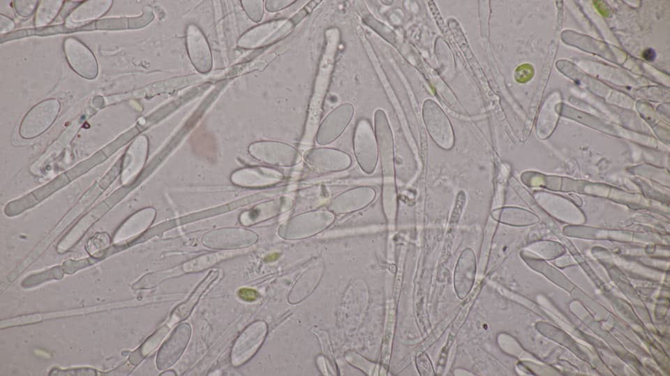 Unter dem Mikroskop sind kleinste Organismen zu sehen. In diesem Fall die Pilzgattung Lachnellula.