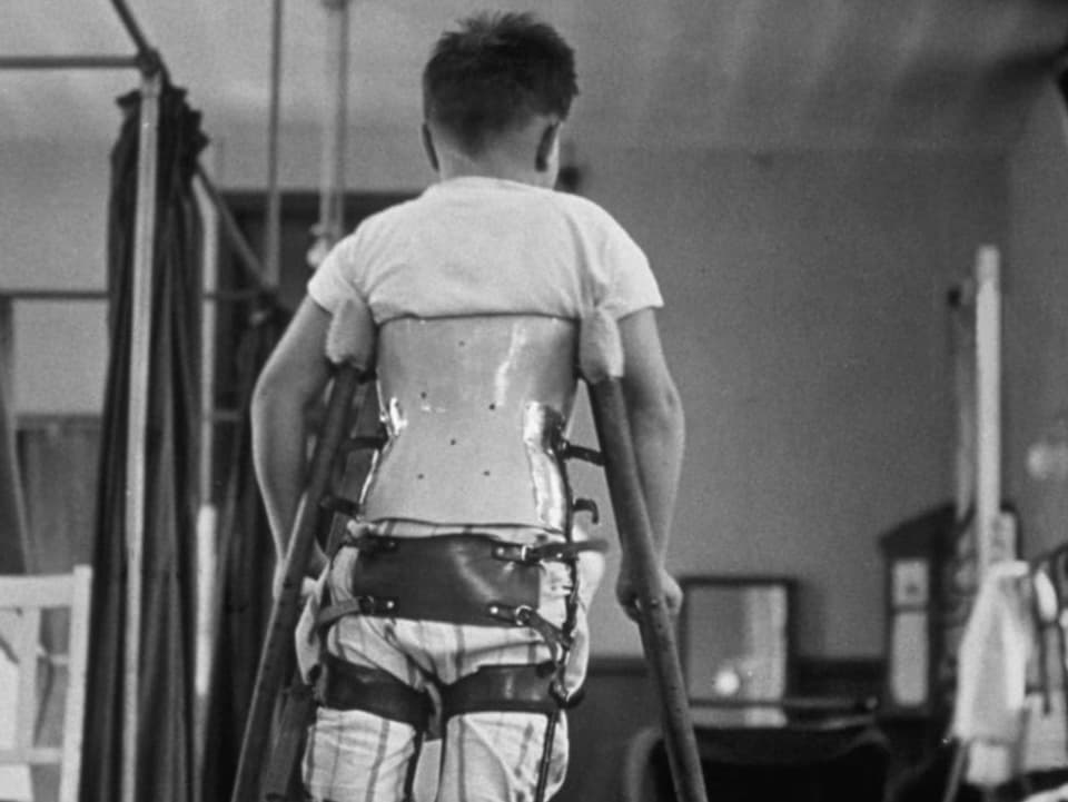 The picture shows a child with a crutch.