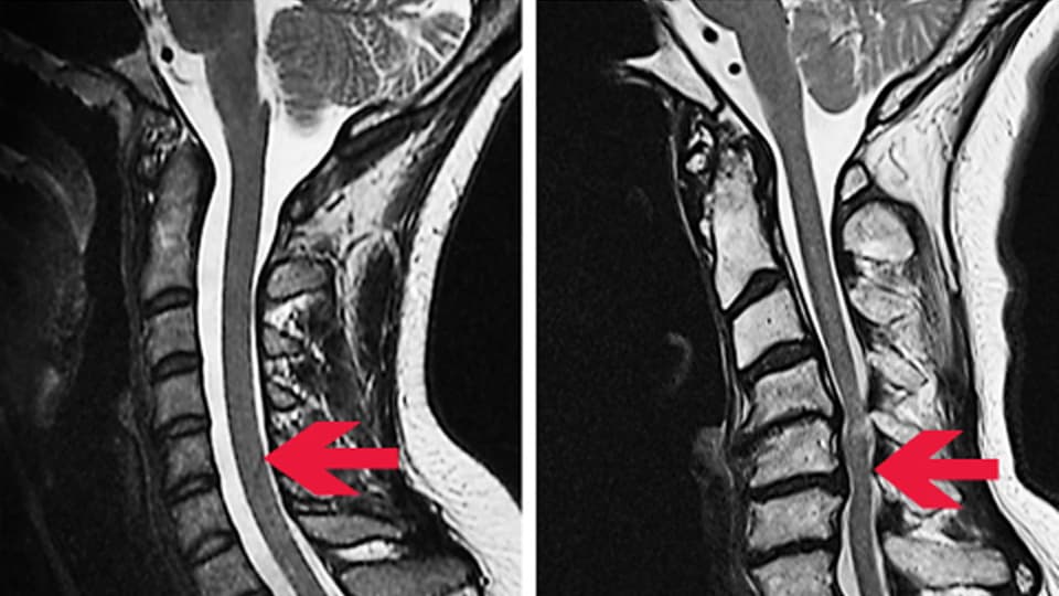 MRI MRI
