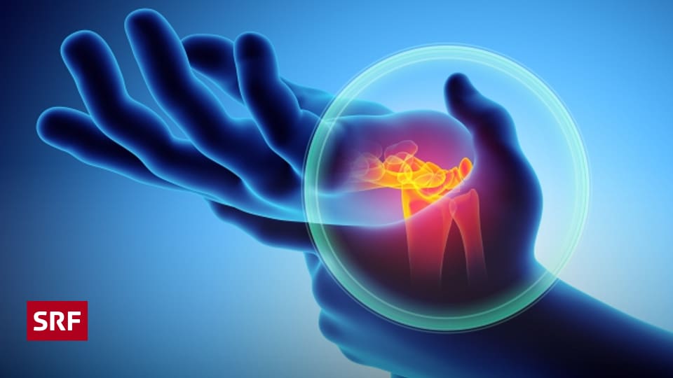 Arthrose Möglichst lange ohne OP Ratgeber SRF
