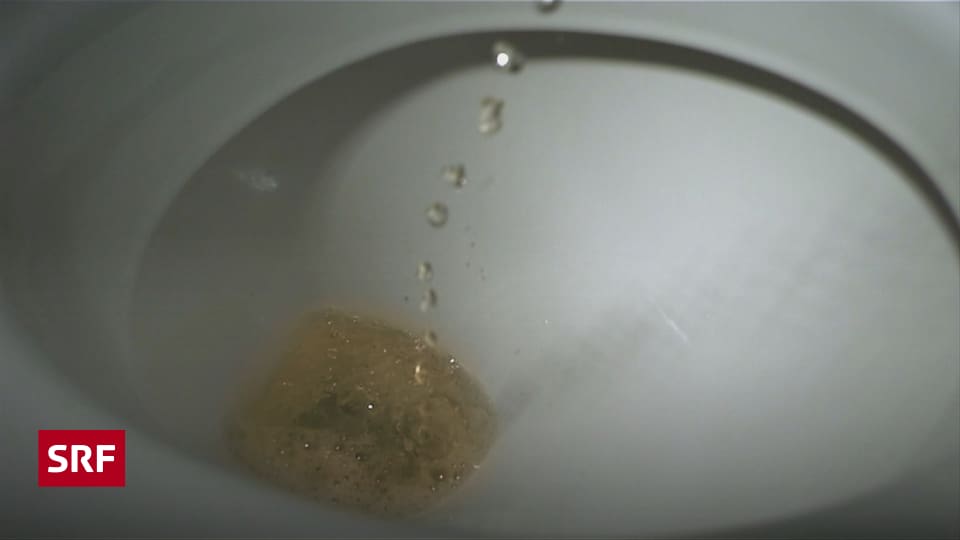 Wissenschaft des Urins Mehr als nur ein Abfallprodukt Wissen SRF