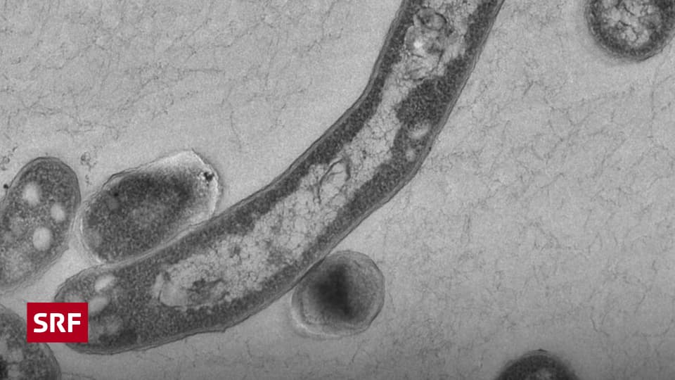 Kesehatan Masyarakat – Tuberkulosis – Epidemi yang Terlupakan – Pengetahuan