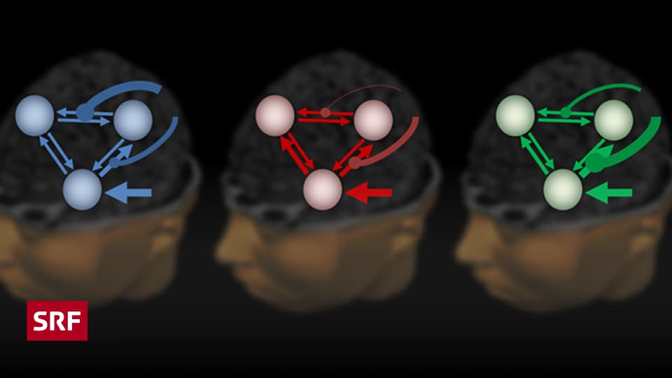 Fünfmalklug - Wie diagnostiziert man Schizophrenie? - Einstein - SRF