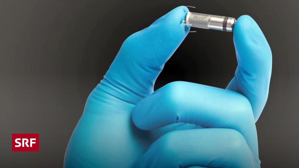  MiniHerzschrittmacher mit grosser Leistung Wissen SRF