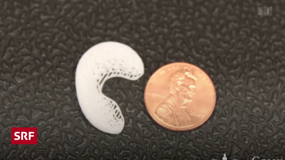 Meniskus aus dem 3D-Drucker mit neuen Knorpelzellen - Wissen - SRF