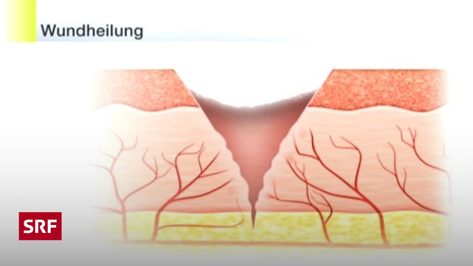 Kratzwunden behandeln – so geht's