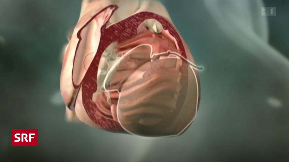 36+ Wenn das herz zerbricht mediathek