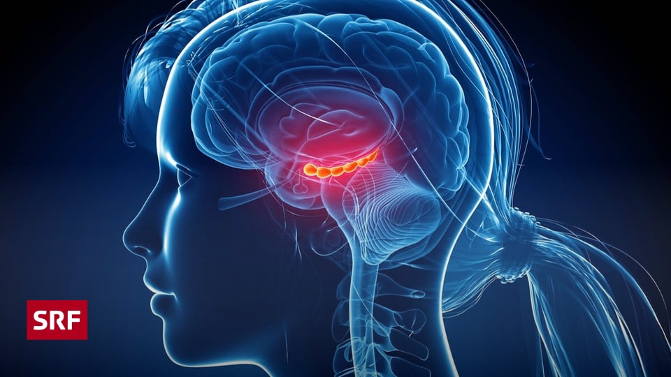 Kurzzeitgedächtnis So funktioniert es Wissen SRF