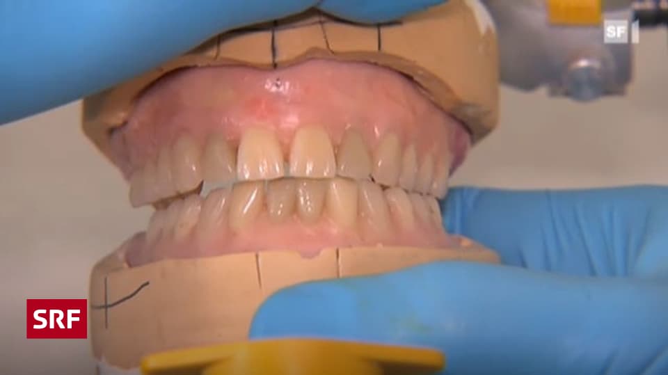 Gaumenplatte zahnprothese ohne zahnprothese oberkiefer