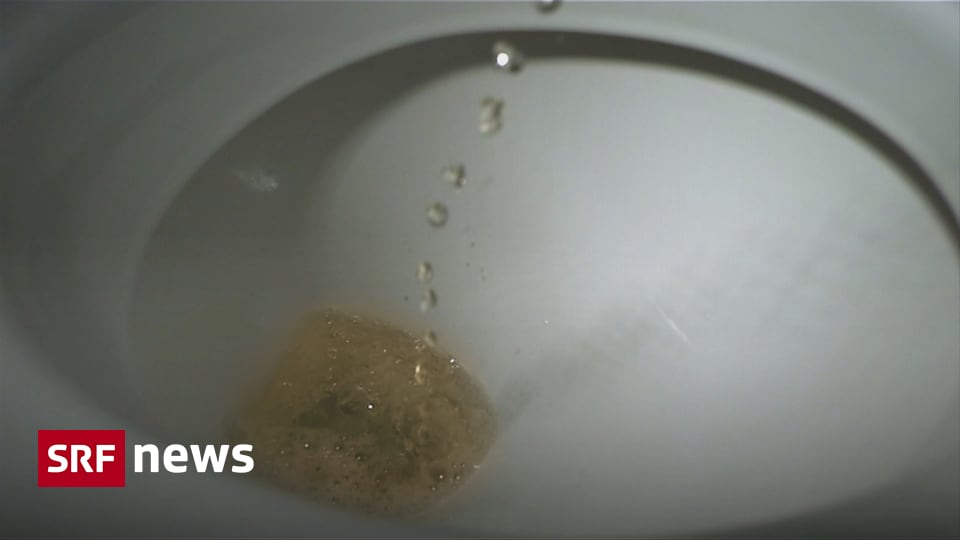 Wissenschaft des Urins - Mehr als nur ein Abfallprodukt - News - SRF