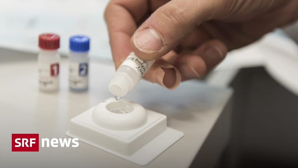 Kampf gegen Aids Bundesrat will HIV und HepatitisAnsteckungen bis 2030 ausmerzen News SRF